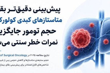 حجم تومور جایگزین نمرات خطر سنتی می‌شود