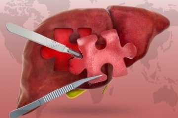 «روز جهانی هپاتیت»؛ آگاهی‌بخشی برای رفع موانع پیشگیری و درمان