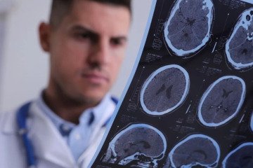 اختلال خواب، کنترل هیجانات و تصمیم‌گیری مغز را مختل می‌کند
