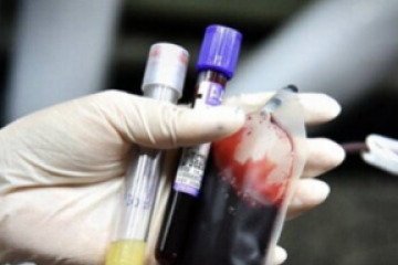 بخشی از نیاز کشور به فاکتور انعقادی ۱۳ تامین و آماده توزیع شد