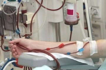 ۱۸ بیماری جدید به فهرست بیماری‌های نادر ایران افزوده شد