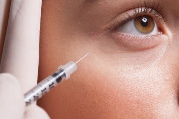 فریب فیلرهای ارزان و اینترنتی را نخورید