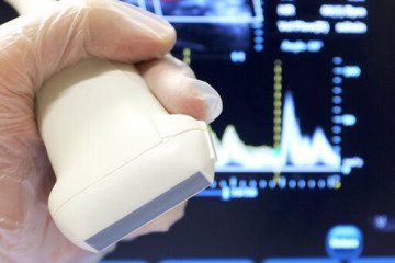 سونوگرافی داپلر رنگی؛ راهی برای شناسایی عوارض فیلرهای زیبایی