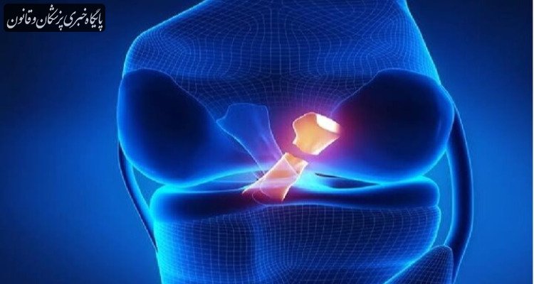 مقایسه دو روش ترمیم مینیسک زانو در پژوهش محققان ایرانی