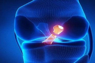 مقایسه دو روش ترمیم مینیسک زانو در پژوهش محققان ایرانی