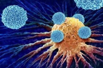 امیدی تازه برای درمان سرطان استخوان در کودکان با مدل هوشمند