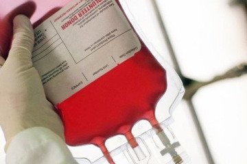 دستور وزیر بهداشت برای افزایش مشارکت مراکز درمانی دولتی و خصوصی جهت تقویت ذخایر خونی کشور
