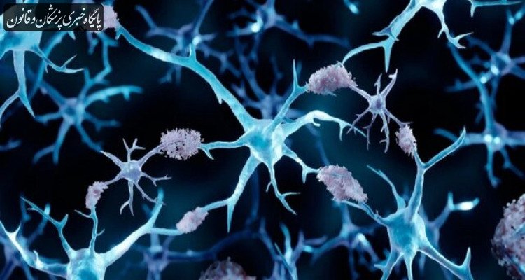 کشف راهی جدید برای مقابله با آلزایمر