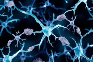 کشف راهی جدید برای مقابله با آلزایمر