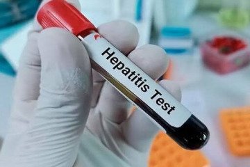 ابتلا به هپاتیت زیر سایه ناآگاهی