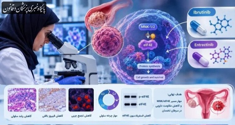 امید تازه پژوهشگران برای هدف‌گیری مسیر مولکولی مقاومت سرطان تخمدان به شیمی‌درمانی