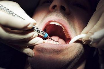 ورود یک کارخانه داروسازی جدید به چرخه تولید کارپول دندانپزشکی