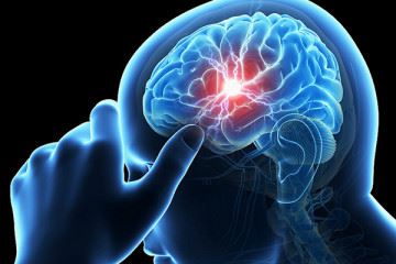 استفاده از تکنیکی جدید به منظور طبقه‌بندی انواع بیماری صرع
