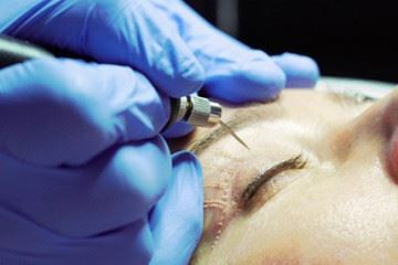 غیر علمی بودن مباحثی تحت عنوان «پلاسما درمانی برای رفع چین و چروک‌های صورت»