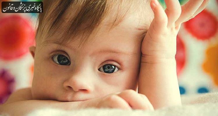 اگر غربالگری صورت نگیرد هر سال ۲۵۰۰ نوزاد مبتلا به سندروم داون متولد میشود اگر غربالگری صورت نگیرد هر سال ۲۵۰۰ نوزاد مبتلا به سندروم داون متولد میشود