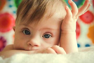 اگر غربالگری صورت نگیرد هر سال  ۲۵۰۰ نوزاد مبتلا به سندروم داون متولد می‌شود