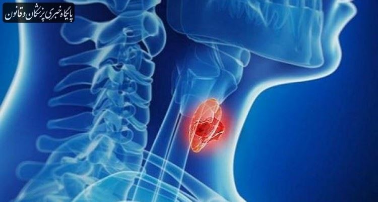 آنچه در مورد سرطان تیروئید باید بدانید آنچه در مورد سرطان تیروئید باید بدانید