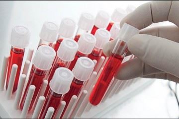 ۴ هزار نمونه خون بند ناف در بانک خون بندناف ملی ایران ذخیره شده است