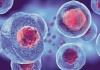 ضرورت توسعه خدمات بالینی مبتنی بر فناوری سلول‌های بنیادی