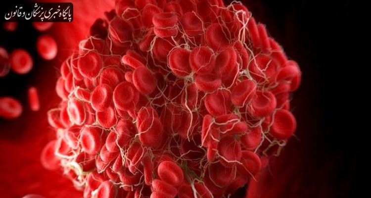 عوامل اکتسابی و ارثی ایجاد لخته های وریدی خون