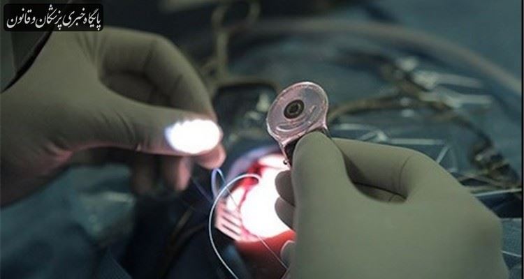 در ۵ ماه گذشته ۴۵۰ مورد عمل جراحی کاشت حلزون انجام شده است