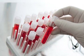 سلامت افراد با اهدای سلول‌های بنیادی خون ساز به خطر نمی‌افتد