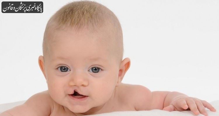 شکاف لب و کام از شایع‌ترین بیماری‌های مادرزادی در ناحیه سر و صورت است