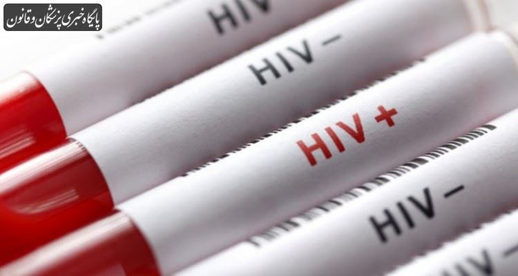 راه انتقال ویروس HIV از مسیر سرنگ آلوده قطعا منتفی است