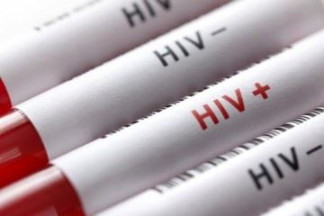 راه انتقال ویروس HIV از مسیر سرنگ آلوده قطعا منتفی است