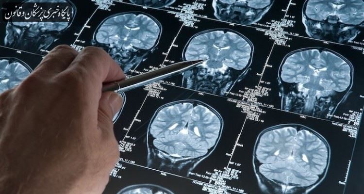 کاربرد نقشه‌برداری مغز در تشخیص بیماری‌های روان‌پزشکی و عصب‌شناختی