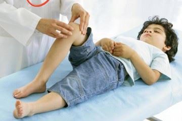 دردهای عضلانی اسکلتی شایع‌ترین دلیل مراجعه کودکان به کلینیک‌های روماتولوژی