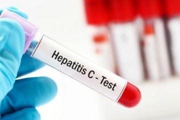دلایل کمبود داروهای بیماران مبتلا به هپاتیت سی و عدم دسترسی به دوز مناسب