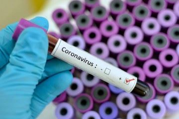 آخرین وضعیت کرونا ویروس در خاورمیانه