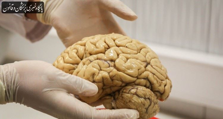بانک مغز یک بانک ملی برای انجام تحقیقات درحوزه بیماری‌های مغز و اعصاب است
