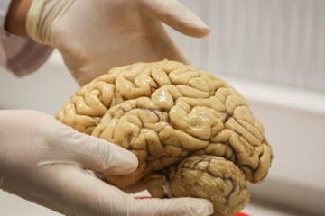 بانک مغز یک بانک ملی برای انجام تحقیقات درحوزه بیماری‌های مغز و اعصاب است